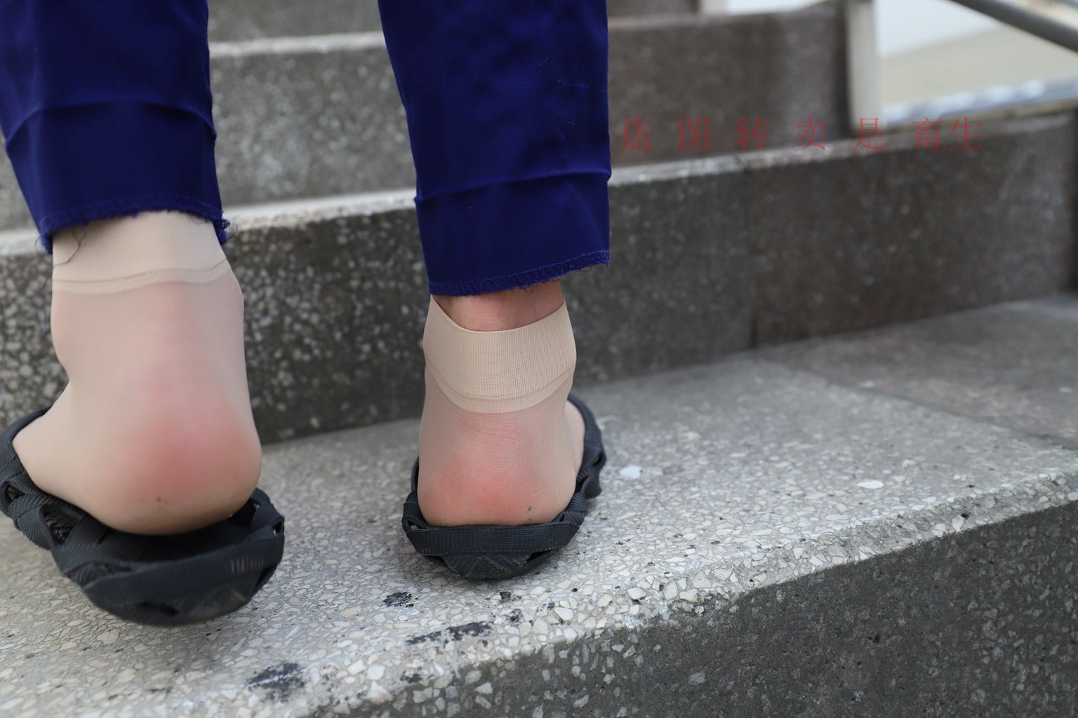 图片[77]-[大西瓜爱牙膏] S系列 S052 方案七-5-集美图