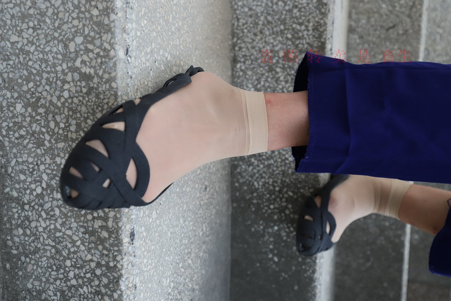 图片[106]-[大西瓜爱牙膏] S系列 S052 方案七-5-集美图